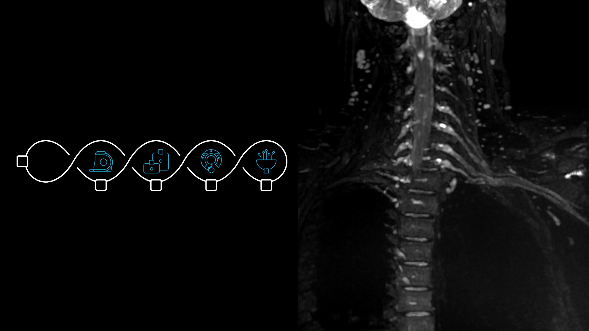 GEHCAIRTechUmbrellaWebpageClinicalGalleryImage1