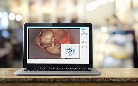 Tecnologia 4DView di Voluson