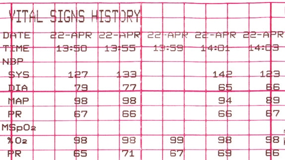 hotspot tours-mic-corometrics 250cx-gehc-corometrics-250cx_hotspot_4_jpg